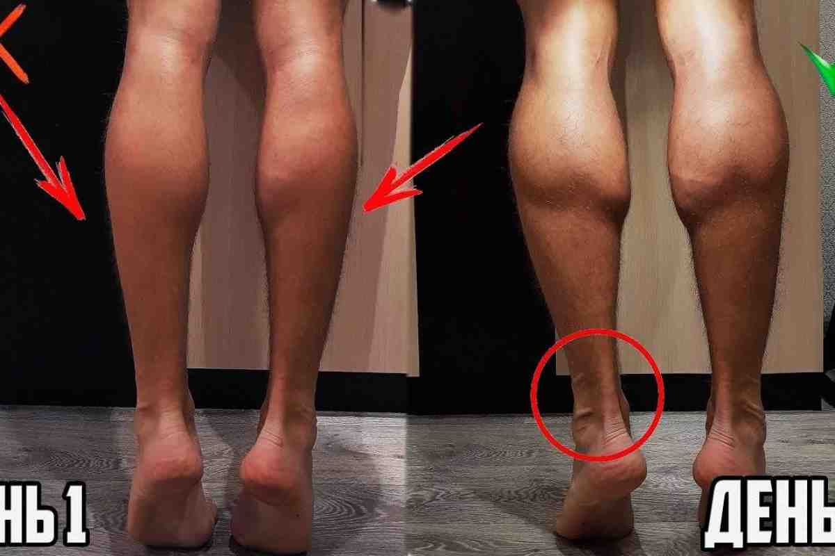Чем отличаются мужские ноги от женских. Накаченные икры ног. Накаченные икры до и после. Икры ног мужские. Икроножная мышца ноги.